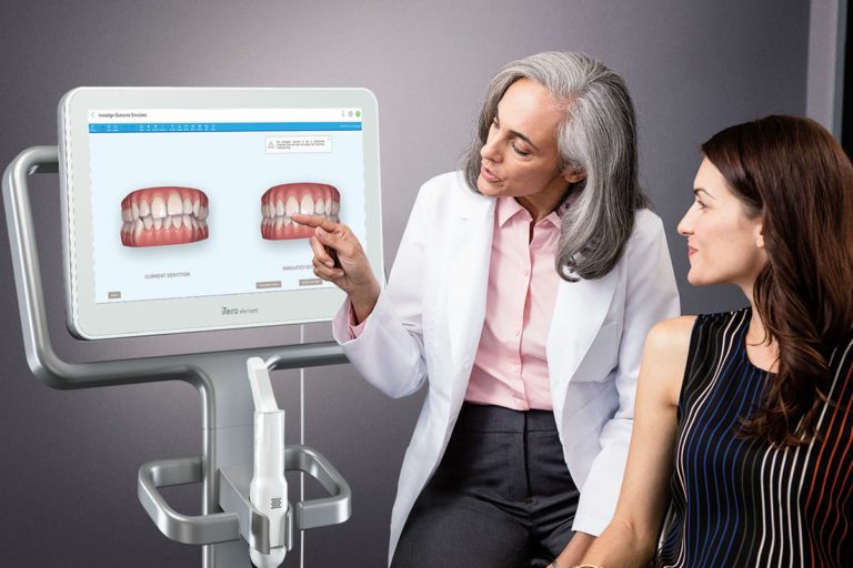 ITero Intraoral Digital Scanners Everything You Need To Know