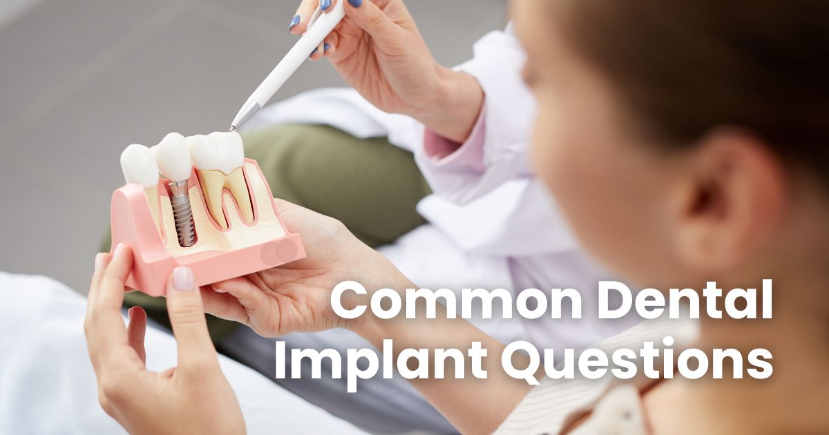 Common Dental Implants – Questions & Answers